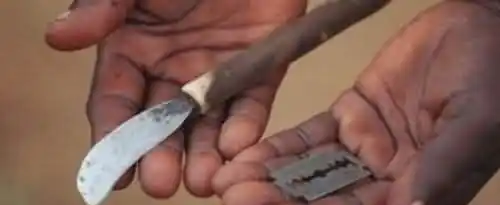 非洲割礼指的是什么？